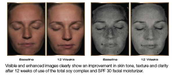 skin tone and texture clinical study 4