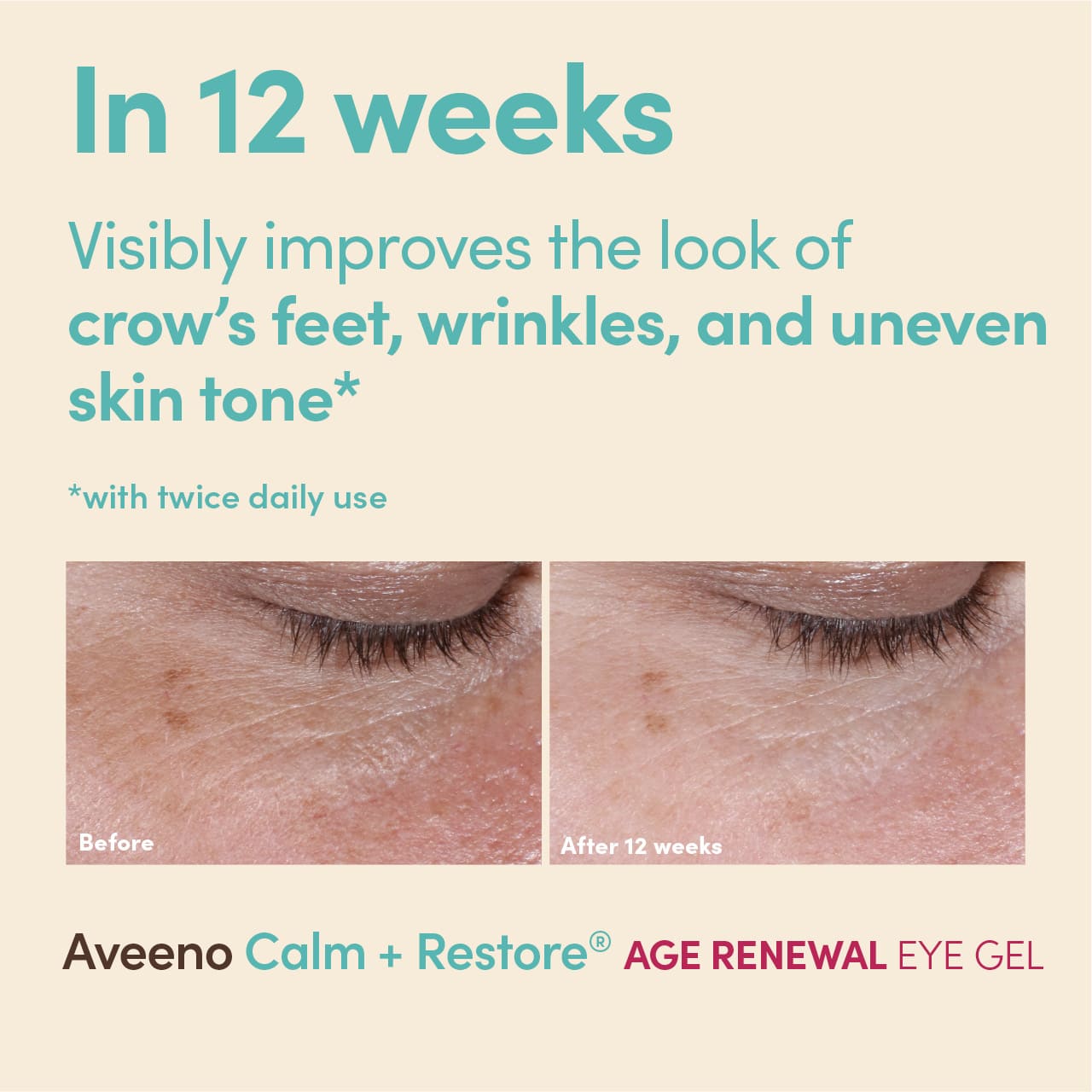 Before and after pictures of under eye area after the use of AVEENO® eye gel with a claim ‘visibly improves the look of crow’s feet, wrinkles, and uneven skin tone in 12 weeks’